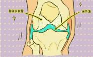 膝盖关节痛什么原因